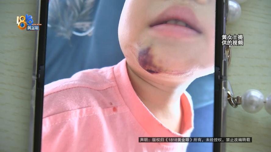 学生摔倒家长索赔8万,学生摔倒家长索赔8万元